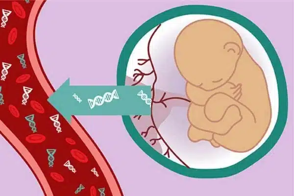 Xét nghiệm NIPT là gì? Có nên làm xét nghiệm NIPT?