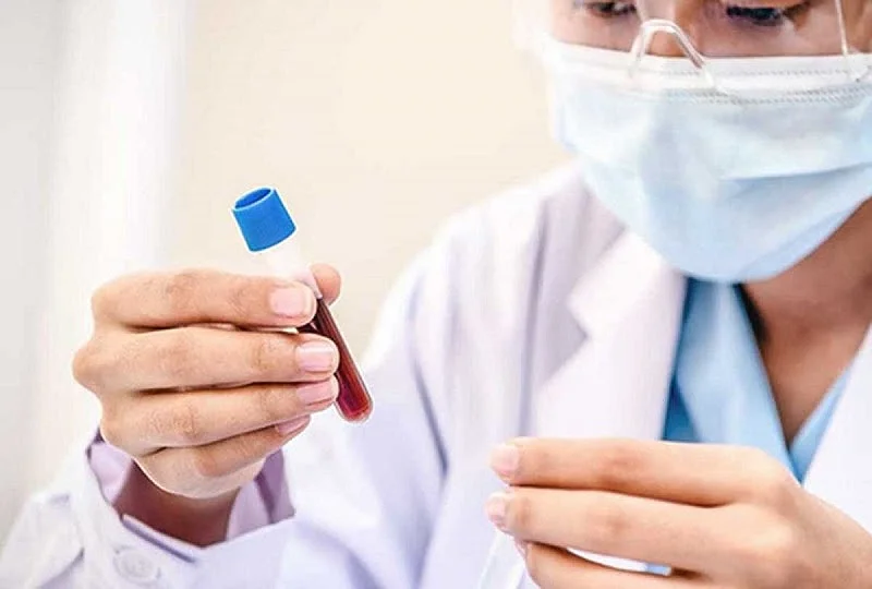 Xét Nghiệm CEA Là Gì? Những Điều Cần Biết Về Xét Nghiệm CEA