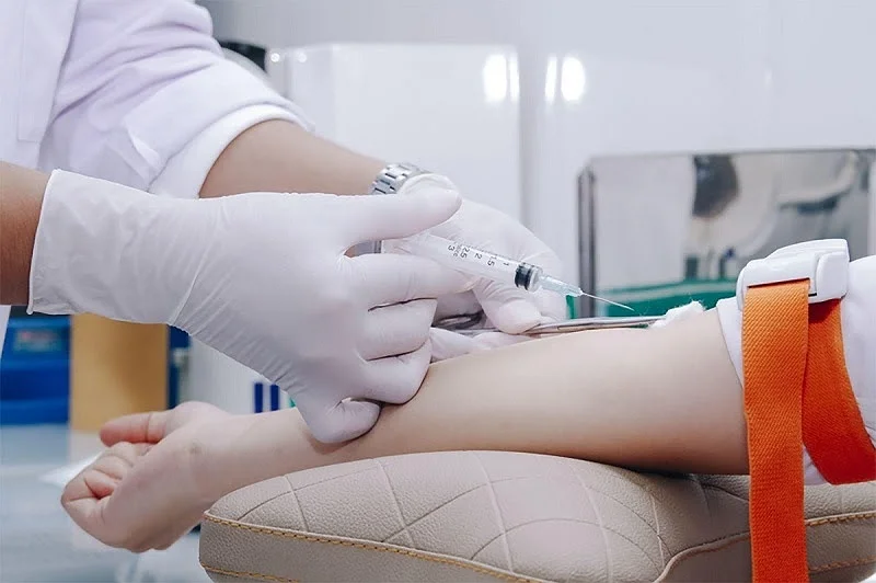 Xét Nghiệm CEA Là Gì? Những Điều Cần Biết Về Xét Nghiệm CEA